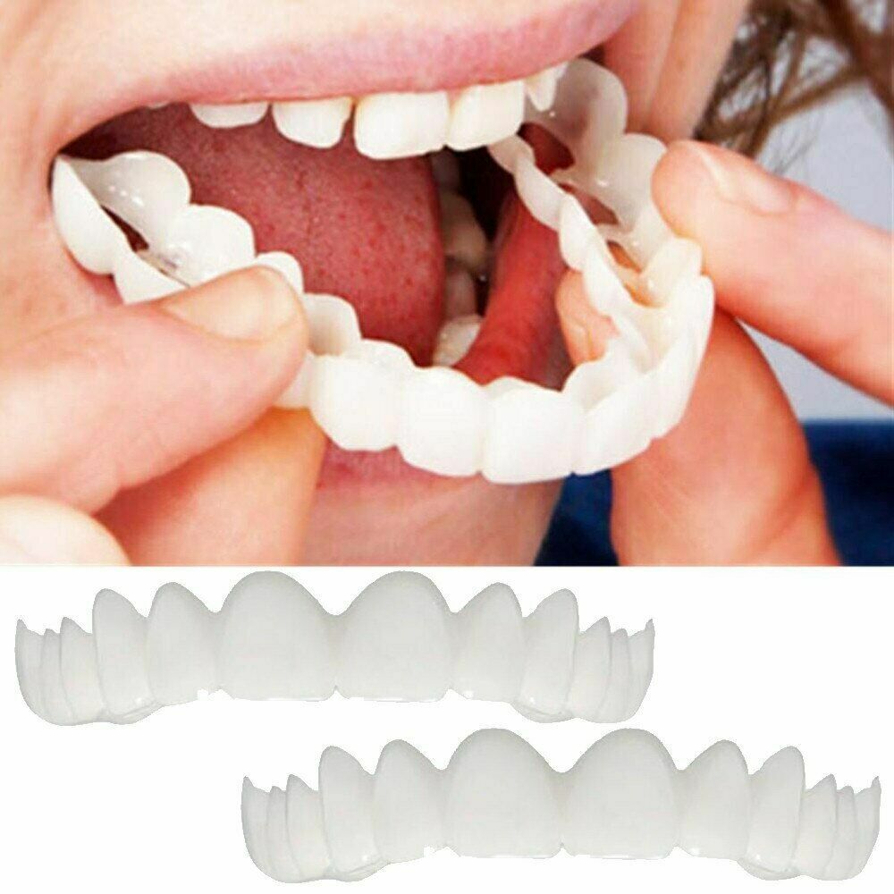 Magic Teeth Brace 2 pcs/set Temporary 