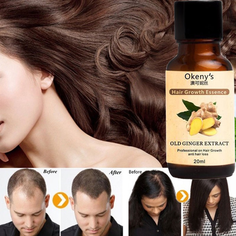 Details About 20ml Fast Hair Growth Serum Anti Hair Loss Liquid Damaged Repair Repair Coarse