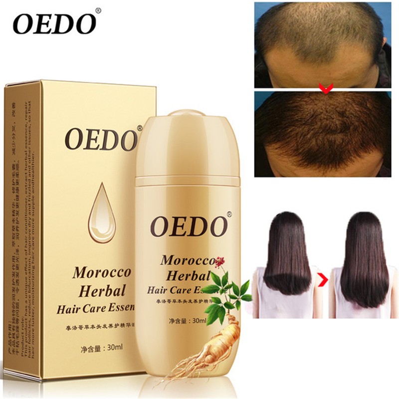 Ginseng Fast Hair Growth Tonic Stop Hair Loss Promote Natural