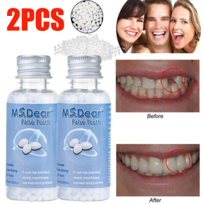 2PCS Tooth Repair Beads Granules,Temporary Moldable Dental Pellets, False Teeth