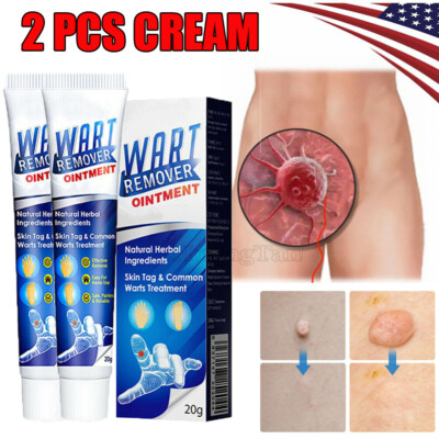 2X Wart Remover Ointment Genital Herpes Genital Antibacterial Treatment Cream US