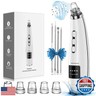 Blackhead Remover Pore Vacuum Upgraded Facial Pore Cleaner Electric Comedone Whitehead Extractor Tool-5 Suction Power,5 Probes,USB Rechargeable Blackhead Vacuum Kit for Women and Men