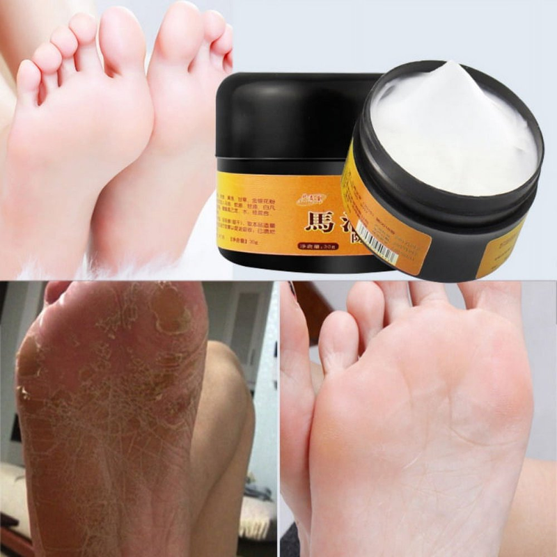 Foot Cream Anti-chapping Skin Repairing Moisturizer For Rough Dry And