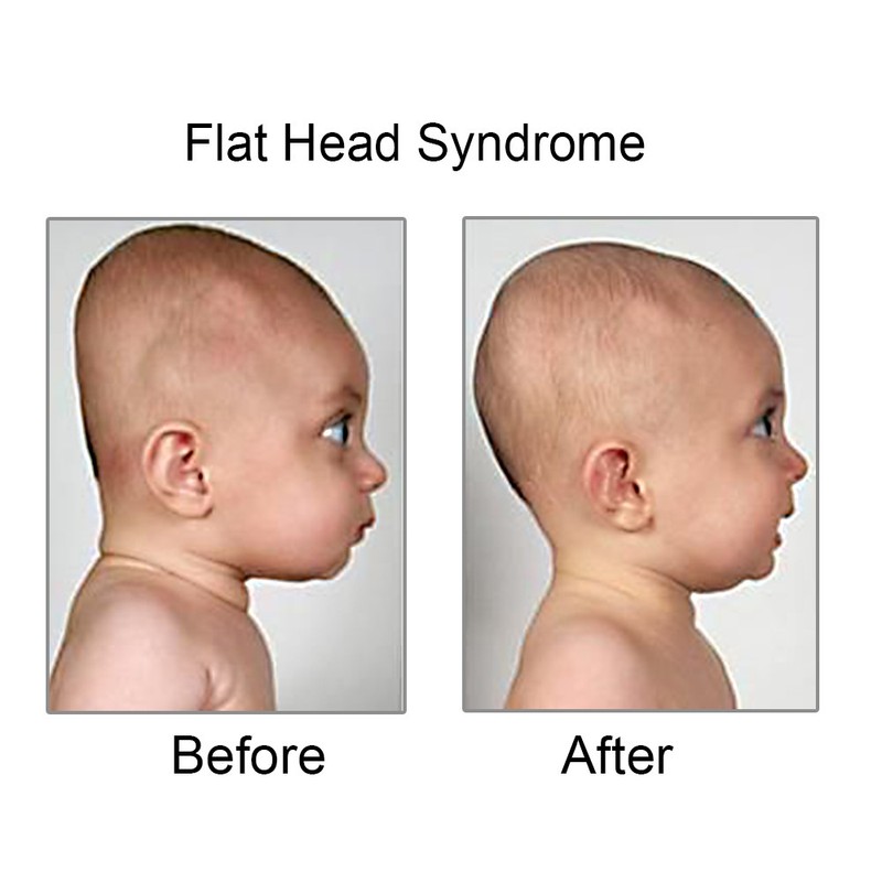 Soft Infant Baby Pillow Prevent Flat Head Memory Foam ...