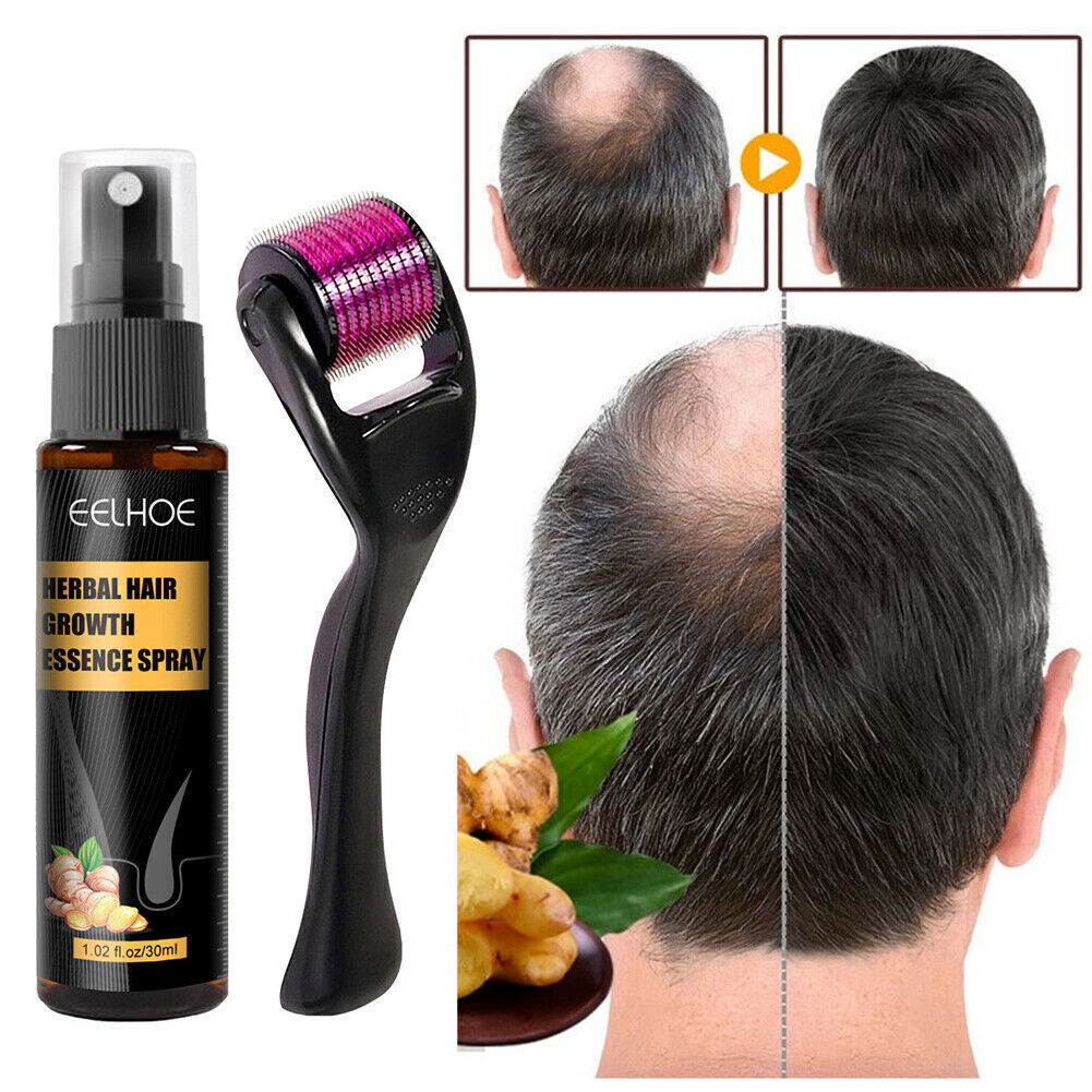 Natural Treatment Herbal Hair Growth Serum Oil Spray Set Regrowth