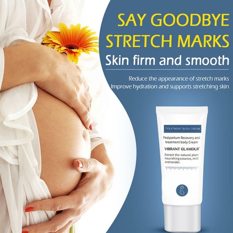 pregnant lady stretch marks cream