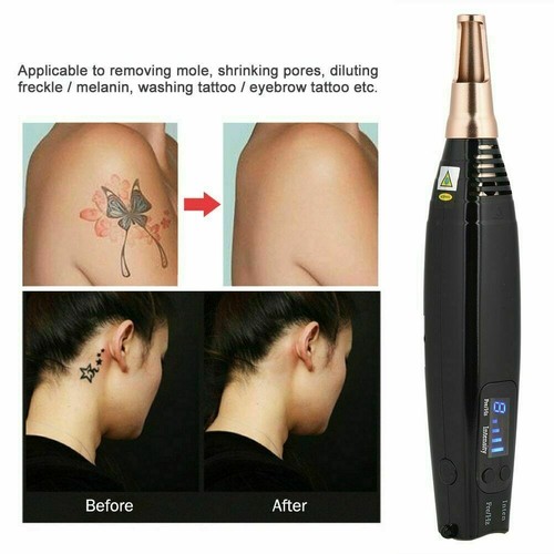 New Version Picosecond Pen II Laser Therapy Beauty For Scar Spot Tattoo Removal