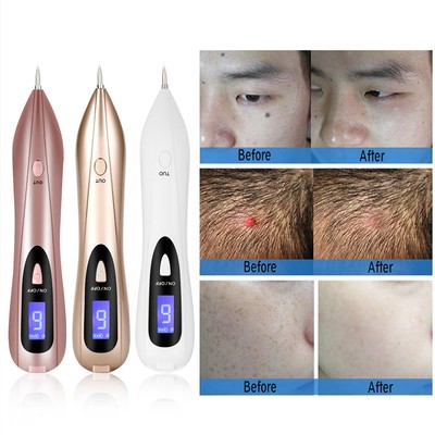 Profi Spot Tattoo Freckle Granulation Mole Dot Warzen Entfernung Stift Maschine