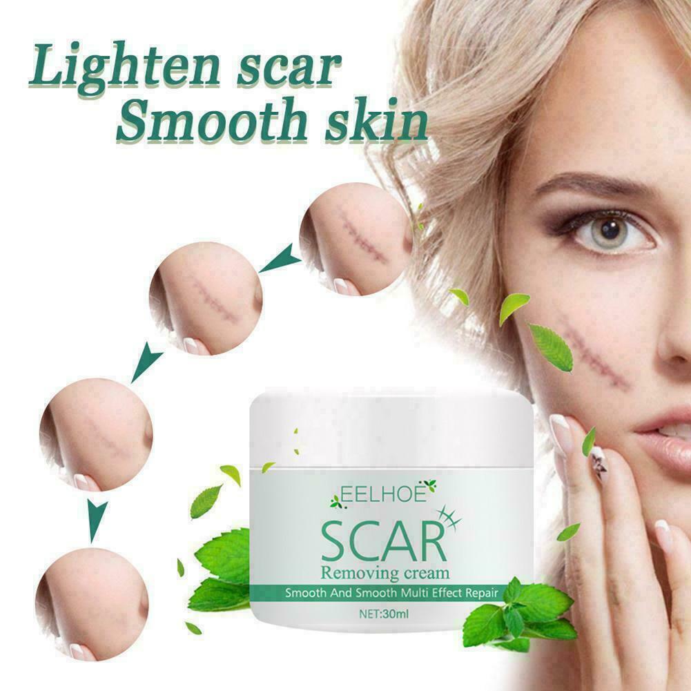 Strong Acne Scar Spots Removal Cream Cuts Burns Stretch Marks Clarifying Skin