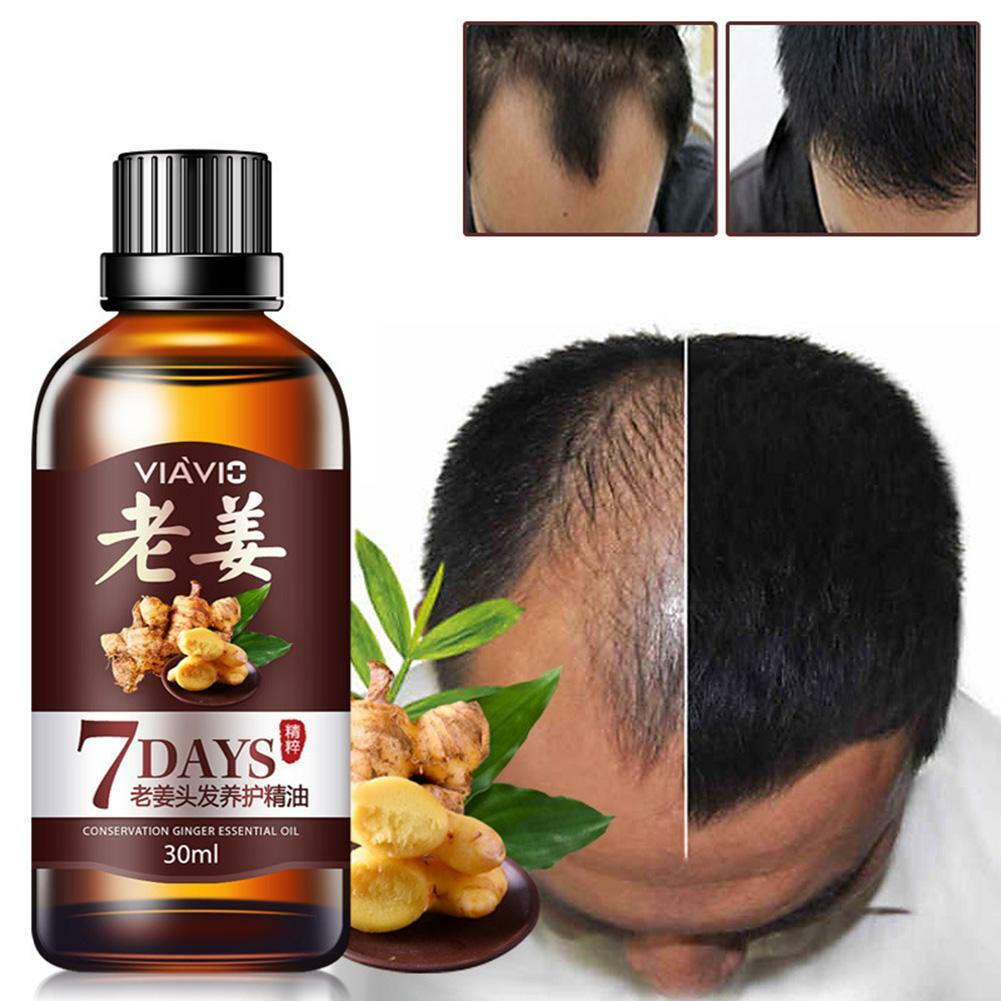 Hair Growth Essence Loss Oil Treatment Ginger Fast Natural Liquid