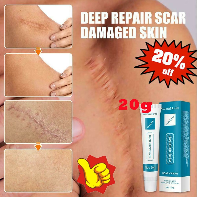 Best Scar removal Cream Skin Care for Scars Reduce Surgery Acne Stretch Marks Ne