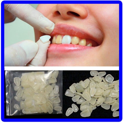 65Pcs/Set Whitening Dental Veneers Resin Teeth Upper ...