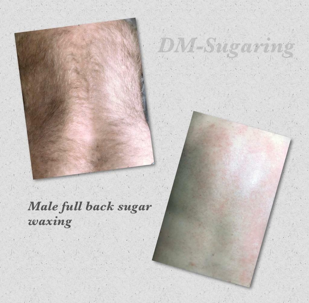 Female Male Sugar Waxing Hair Removal In Wisbech