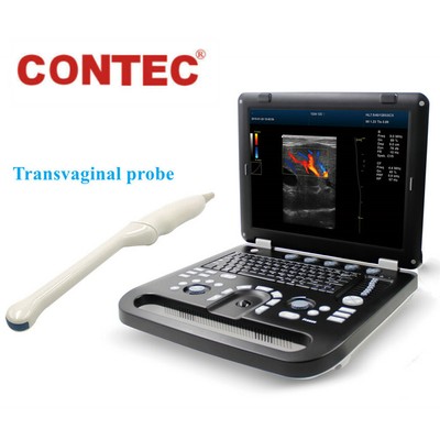 Color Doppler Ultrasound Biopsy Guide IVF BY TVS in-vitro Fertilization CMS1700B