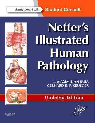 Netter's Illustrated Human Pathology Updated Edition