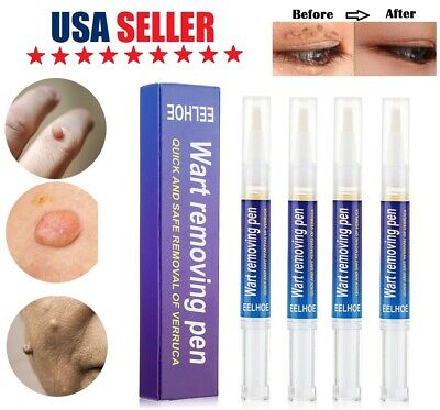 4× Painless Wart Remover Pen Eliminate Skin Tag Foot Corn Mole Warts Restoration