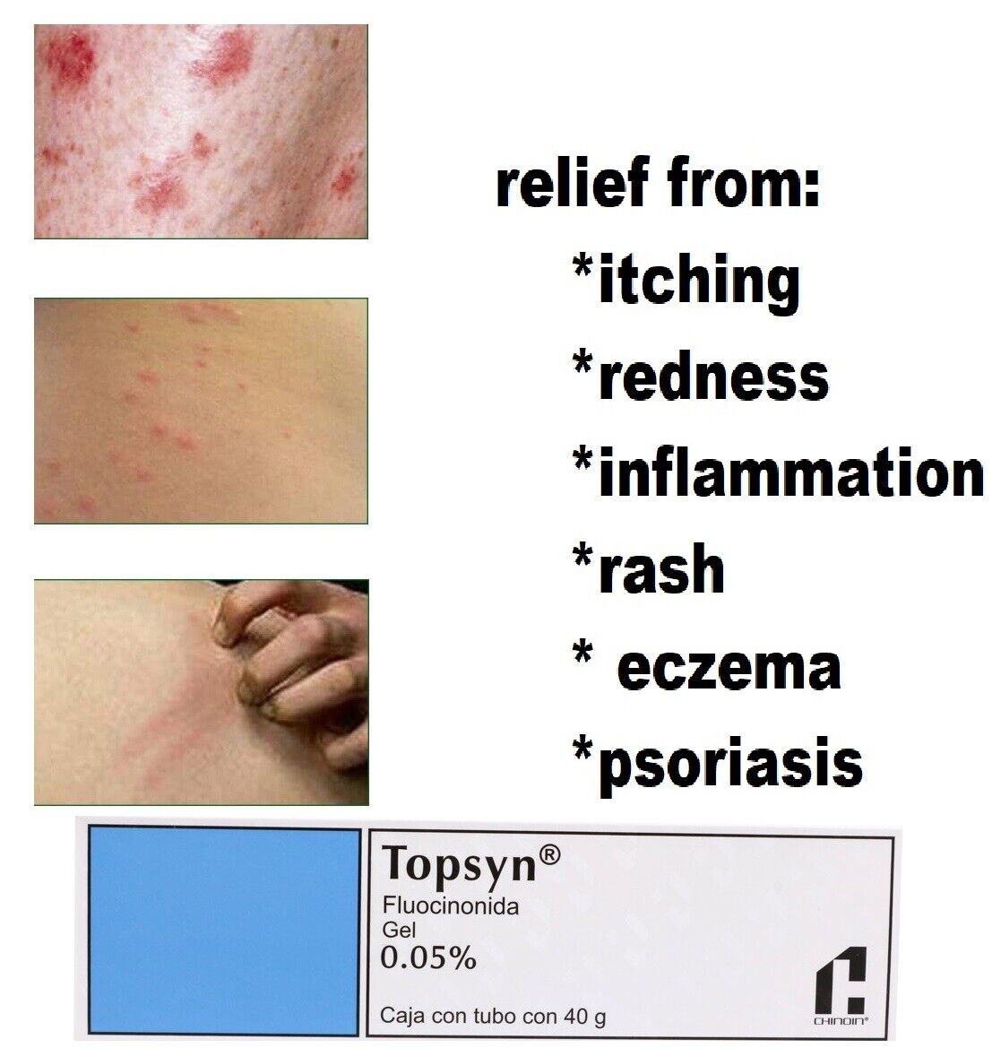 For Psoriasis,eczema,dermatitis Please Try It Now