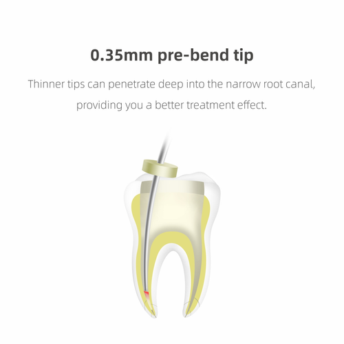 Woodpecker Dental Wireless Gutta Percha Obturation System Endo Heated Pen Fi-P