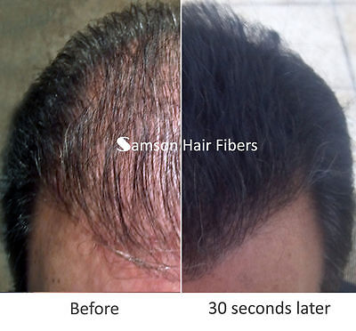 как выглядит Средство от выпадения волос Samson Best Hair Loss Concealer Building fiber refill 50gr MEDIUM BROWN made USA фото