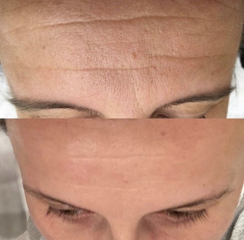 Nu Skin Tru Face Line Corrector