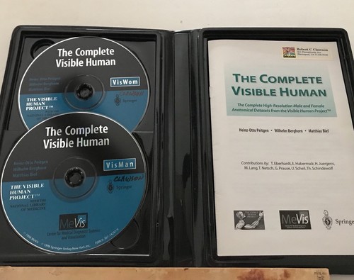 The Complete Visible Human Windows 2 Disc set in case for computer