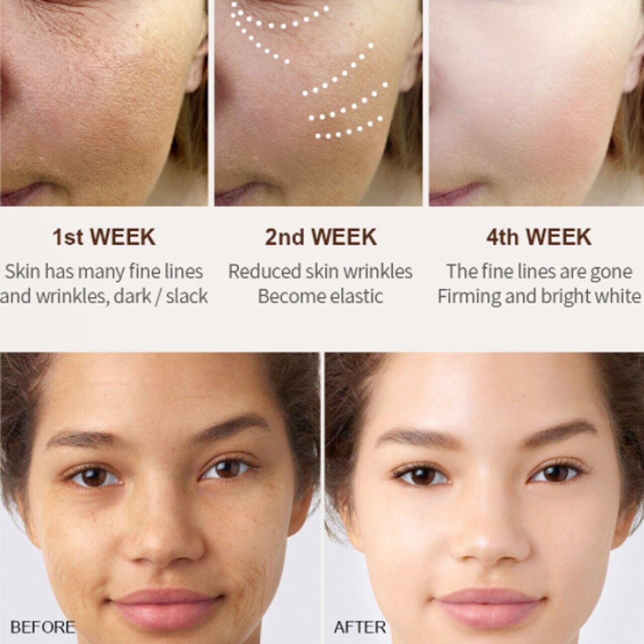 whitening cream Retinol removes melasma acne spots pigment dark spots pigment 