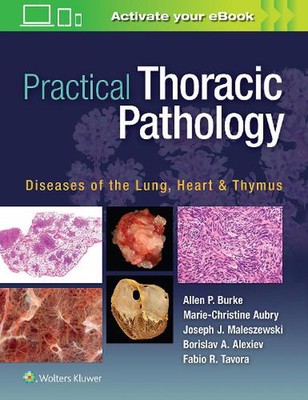 Practical Thoracic Pathology: Diseases of the Lung, Heart, and Thymus by Allen P