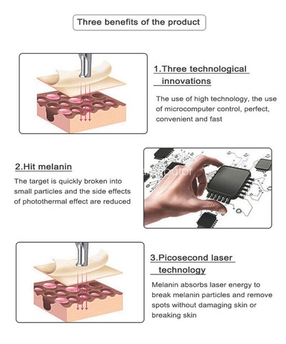 Picosecond Skin Laser Beauty Machine Tattoo/Spot Removal Pigment Pen For Freckle