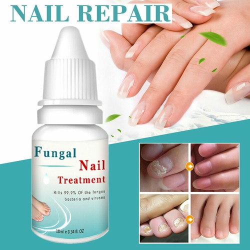 Anti Nagelpilz - 10ml - Nagelpflege & Neuaufbau - Behandlung für Hand & Fuß