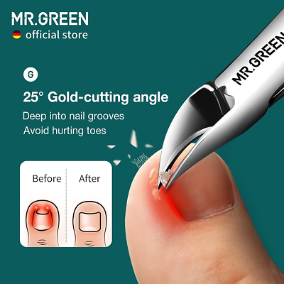 MR.GREEN Nail Clippers Toenail Cutters Anti Splash Professional