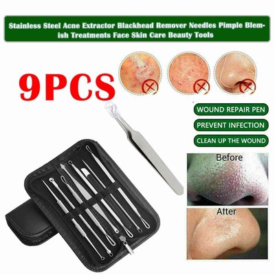  Blackhead Removal Tool Acne Tweezers Pore Cleaner Acne Blemish Extractor Kit