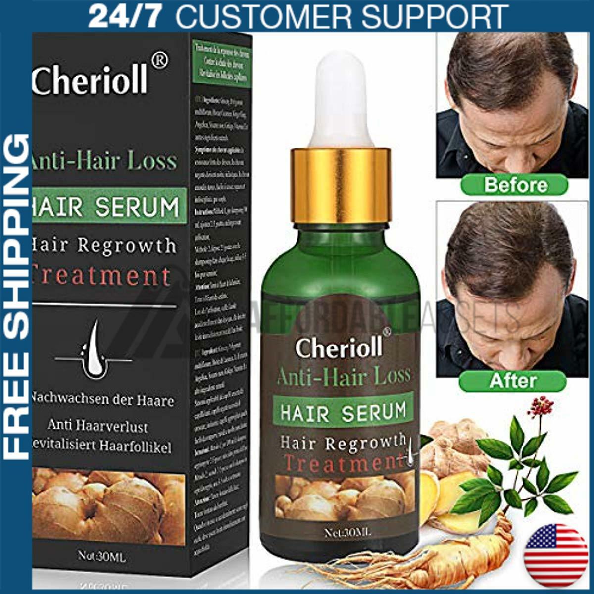 Hair Growth Serum Hair Loss And Hair Thinning Treatment Stops
