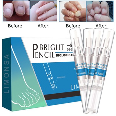 4 tlg gegen Nagelpilz Nagelpflege Stift Nagelbehandlung Anti mykotische Fungus