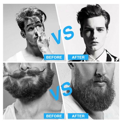 Beard Straightener Brush for Men Ceramic & Ionic Hair Anti-Scald Hot Comb Gift