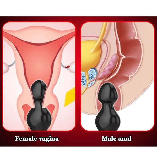 Advanced Sex Toy Anal Butt Plug Huge G-Spot Dildo Pull Beads Sucker Large 5 Size