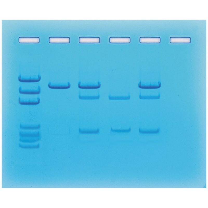 Cancer Gene Detection