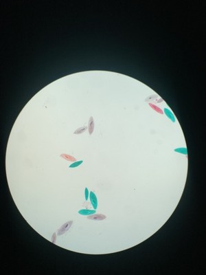 Objectfoto('s) van geverifieerde koper