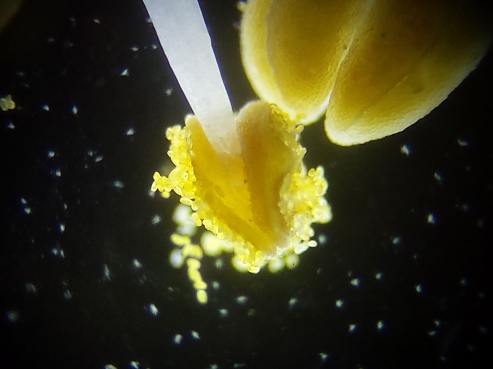 Microscope 32mm Rheinberg Filters Set With Darkfield Lighting - Marvelous Set!!!