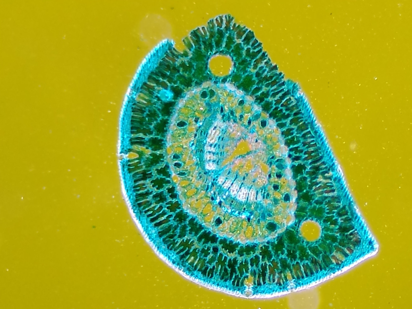 Microscope 32mm Rheinberg Filters Set With Darkfield Lighting - Marvelous Set!!!