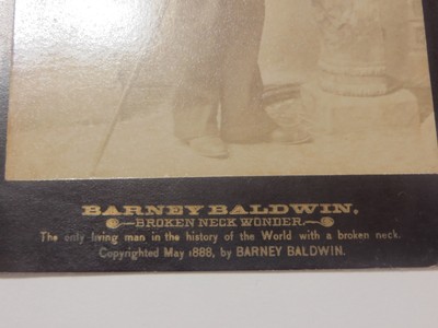 Circus Sideshow Freak Barney Baldwin Antique Cabinet Card Photo Broken Neck