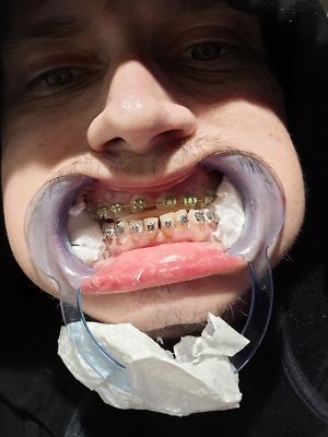 Artikelfoto(s) von einem verifizierten Käufer