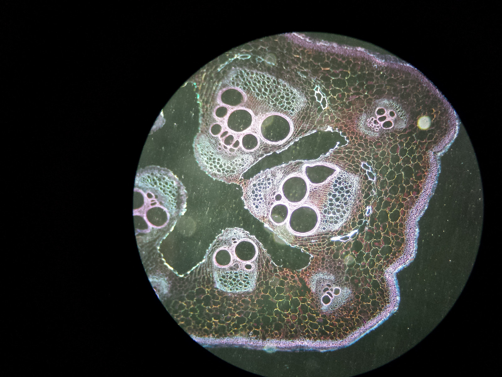 Microscope 32mm Rheinberg Filters Set With Darkfield Lighting - Marvelous Set!!!