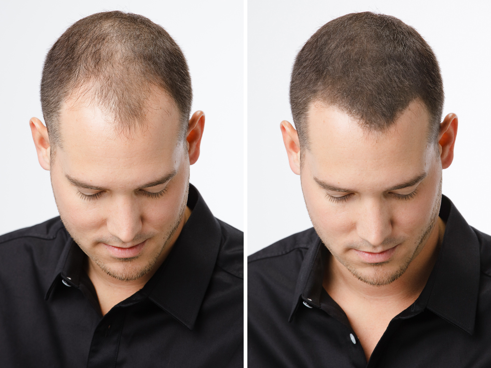 ESPIRITU DE CANELA CINNAMON OIL MEN WOMEN HAIR LOSS BALDING