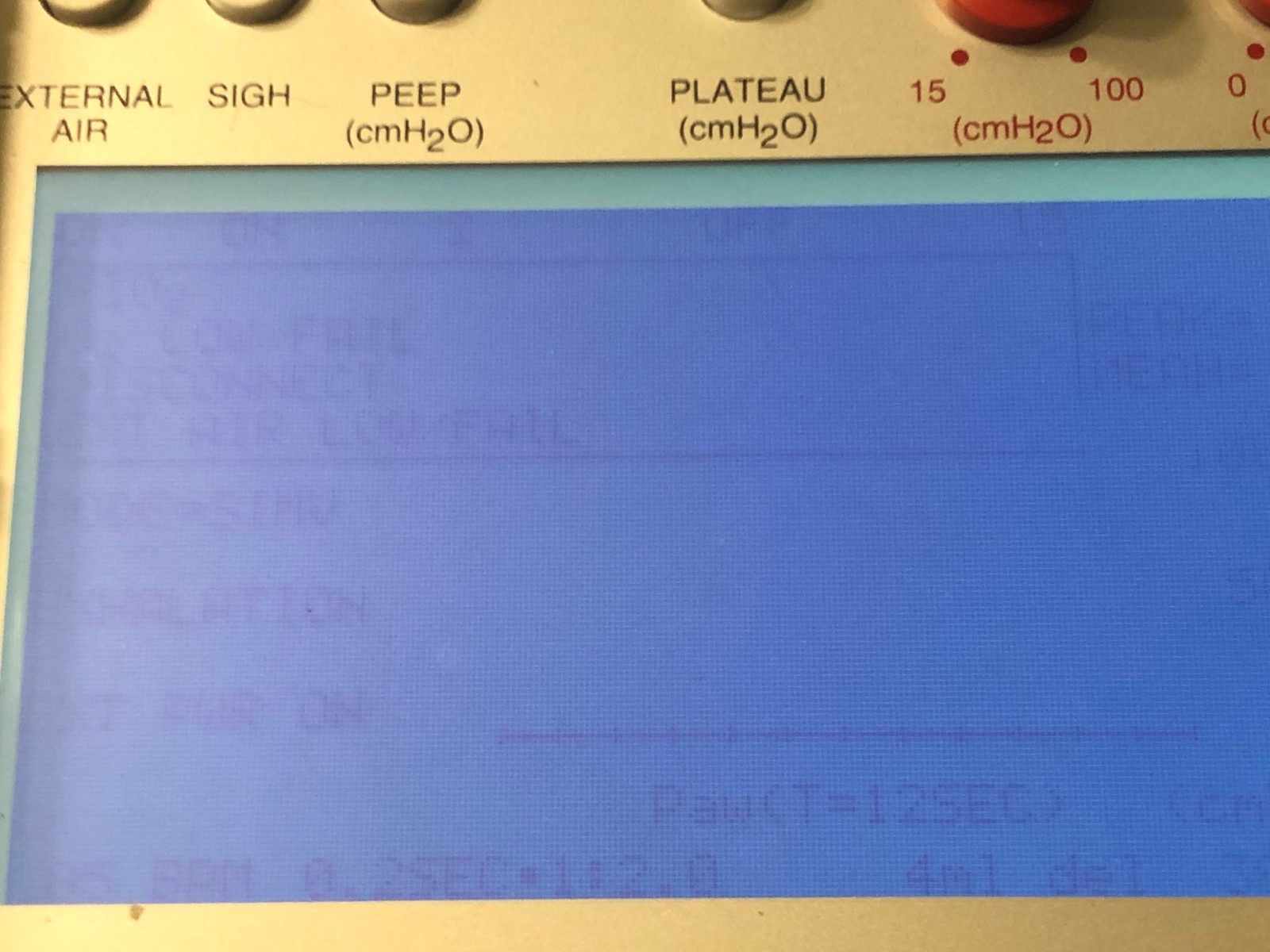 Impact Uni-Vent 754 Eagle Portable Ventilator..... COMPLETE UNIT!!!!