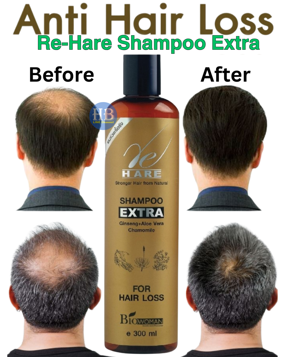 Hair Loss Shampoo Extra Biowoman -Hair Growth Fast Ginseng