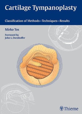 Cartilage Tympanoplasty: Classification of Methods - Techniques - Results by Mir