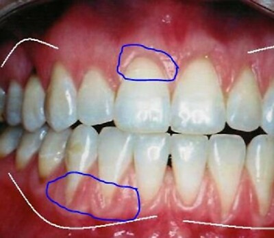 Korea Patent Toothpaste to Repair Gingival Cells & Grow Gum, Only Shop in eBay