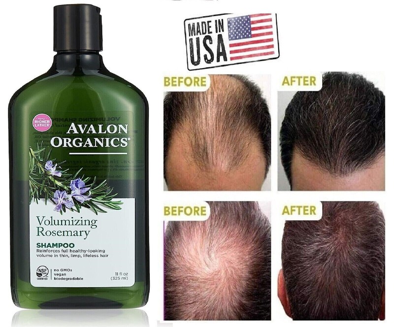 Shampoo Para Crecer El Pelo Alopecia Tratamiento Caida Cabello Champu Calvicie #