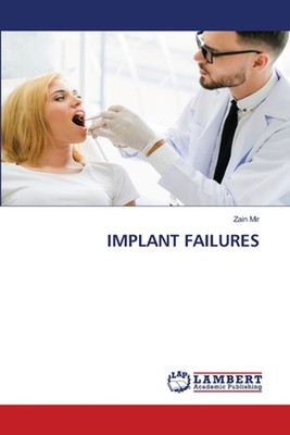 Implant Failures by Zain Mir Paperback Book