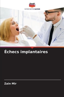 checs implantaires by Zain Mir Paperback Book